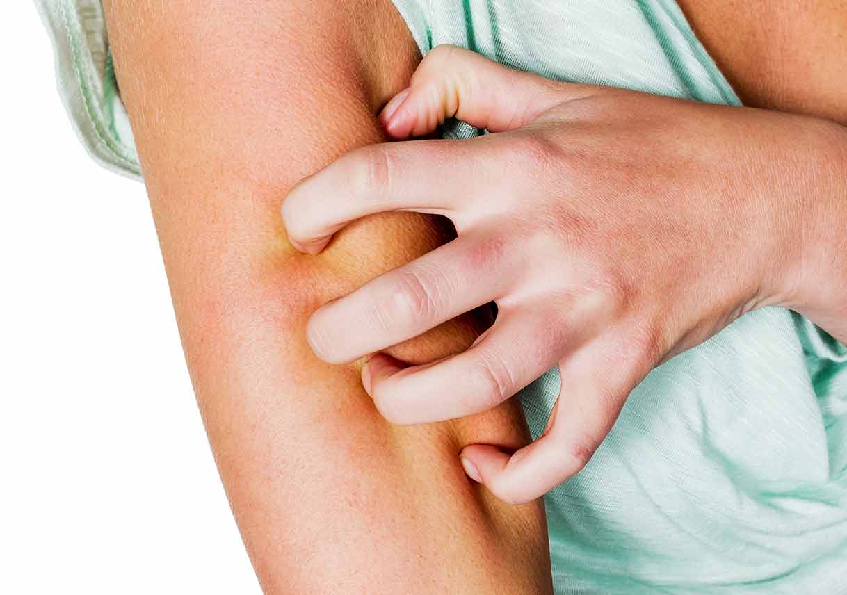 Don’t Invite Mosquitoes to Your Outdoor Party